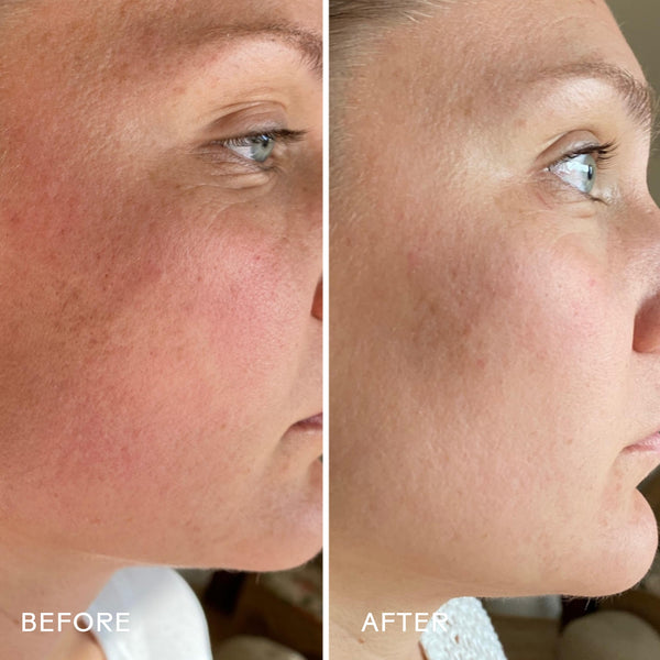 THREE SHIPS SkinHero™ Calendula + 2% Bakuchiol Bio-Retinol Serum